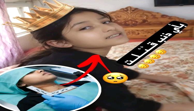وفاة غامضة لطفلة تثير تفاعل اليمنيين وشكوك حول زوجة الأب