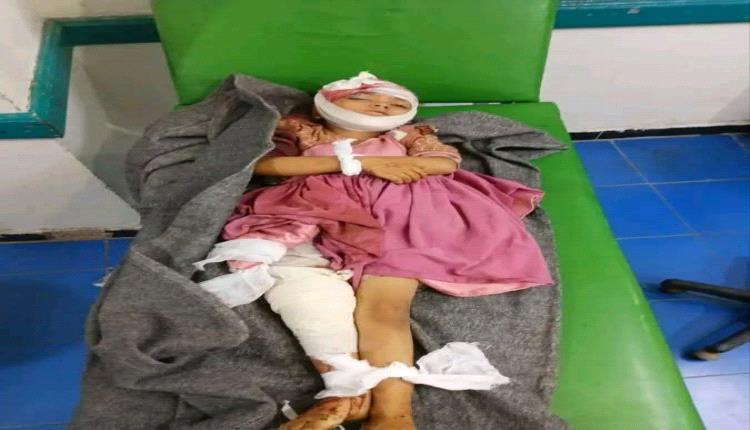عملية بلا تخدير حتى فارقت الحياة.. مأساة الطفلة 