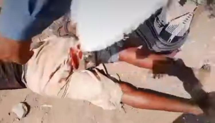 قيادي حوثي يطلق الرصاص على مواطن لنهب أرضه بقوة السلاح جنوب الحديدة