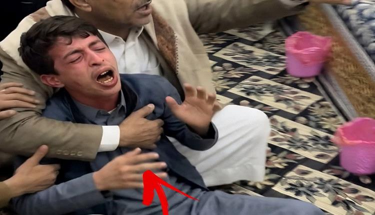 سموم الحوثي المحرمة دولياً تقتل شاب في محافظة عمران