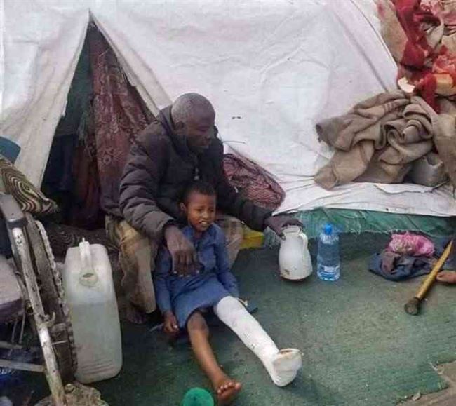 طقم حوثي يصدم طفل ويهرب في إب
