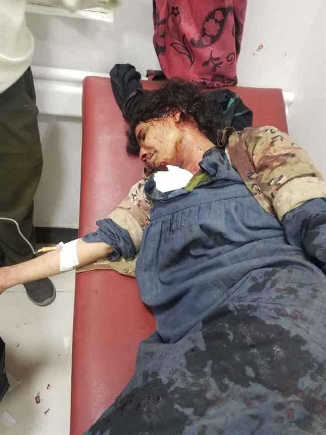 شاهد بالصور.. مسلحو الإخوان يعتدون بوحشية على امرأة بتعز