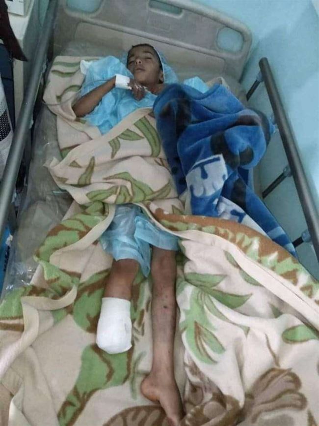 خرج يلعب بجانب منزله فعاد بساق مبتور.. مأساة طفل بالبيضاء سرق الحوثي قدمة