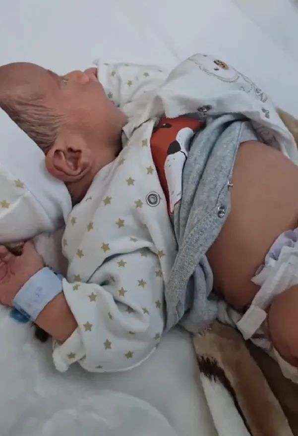 صدم الأطباء بعد ولادته.. طفل يحمل توأمه داخل بطنه في حالة هي الأولى.. صور