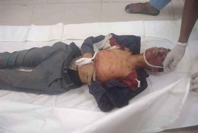 الحوثي يفجر رأس شاب بعدة طلقات نارية في مناطق تعز المحررة
