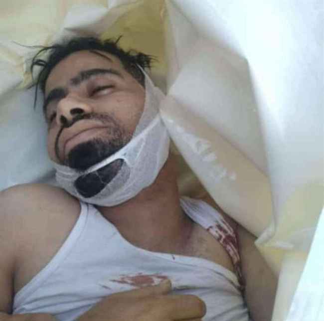 قيادي بمحور تعز يصفي مواطن بطريقة بشعة ويرمي بجثته إلى الشارع