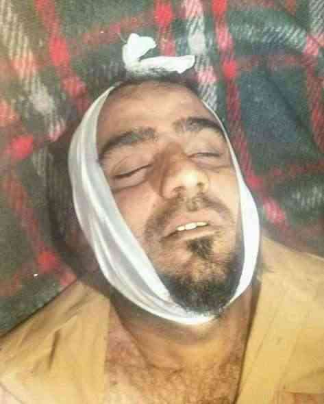 تعز.. أحد مرافقي القيادي طلال الدولار يكشف لـ"نافذة اليمن" ملابسات مقتله في جبهة مقبنة