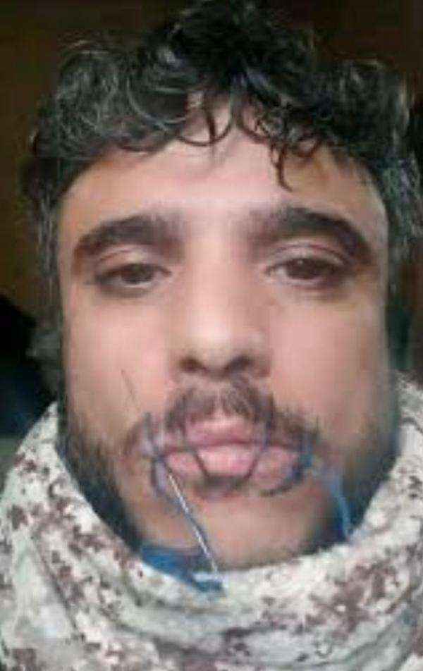 سجين في صنعاء يخيط فمه بعد فضاعة ما تعرض له على أيدي الحوثيين