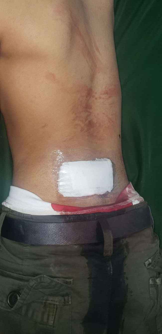 صور مروعة.. مسلحو الحوثي في صنعاء يعتدون بضرب وحشي على شخص أمام طفله