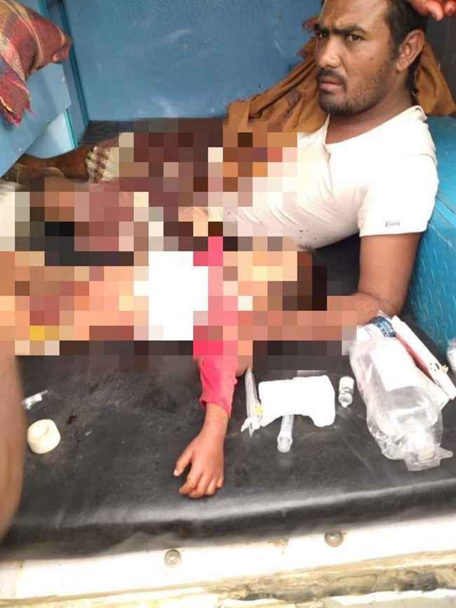 الحوثي يستهدف حيس بالصواريخ.. جريمة بشعة قتلت طفل في الـ4 واصابت أبويه