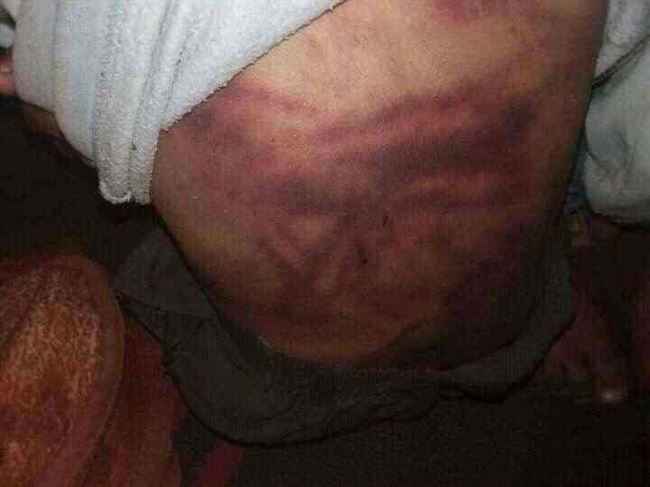 قام بتعذيبها حتى فارقت الحياة.. جريمة بشعة تهز اليمن من أقصاها لأقصاها أب يقتل طفلته بطريقة مروعة.. صور