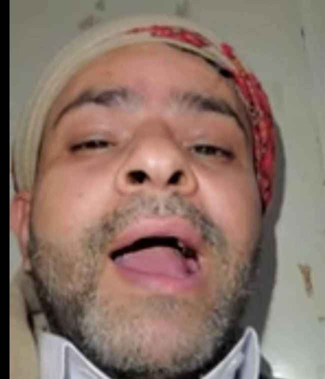 بالفيديو.. قيادي متحوث كبير يبكي بحرقه ويشكو ذليلا من إهانته وتحقيره من قبل كبار السلالة الحوثية