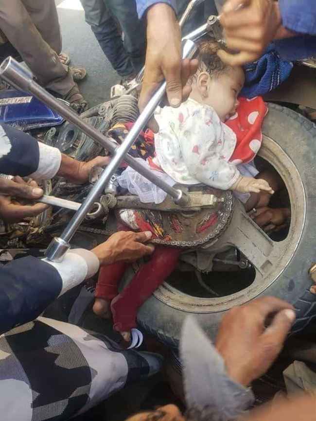 صورة..طفلة صغيرة جداً سقطت من دراجة نارية وعلقت بمكان لا يفصلها عن الموت سوى شعره بتعز