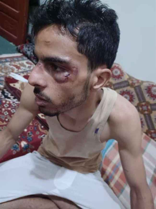 شاب يقدم وجبات لنزلاء السجن المركزي.. مسلحو الحوثي افترسوه أمام البوابة بوحشية غيرت ملامحه
