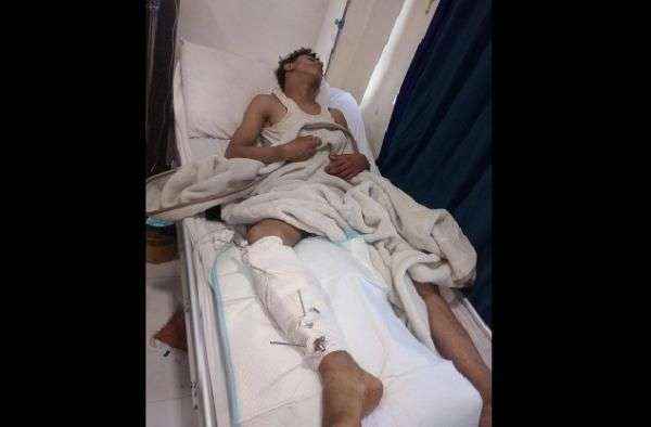 نجل قيادي حوثي بارز يطلق الرصاص الحي على سائق دراجة وسط شارع رئيسي ونقل الأخير للمستشفى