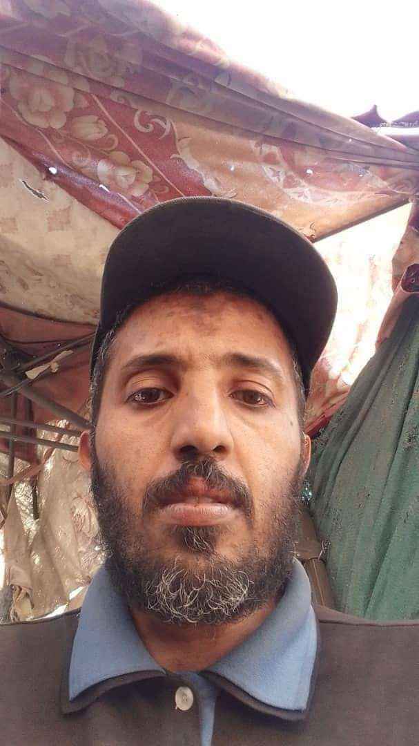 صورة.. عصابة تعتدي على يمنيين بالطعن أثناء خروجهم من السكن للسفر وتنهب أموالهم وهواتفهم