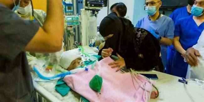 بعد يوم من نجاح عملية فصلهما.. وفاة أحد التوأم السيامي اليمني