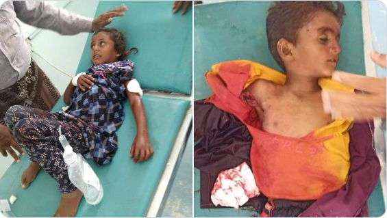 بتواطؤ دولي.. الحوثيون يقتلون طفل وشقيقته تنجو بإصابات بليغة بالحديدة