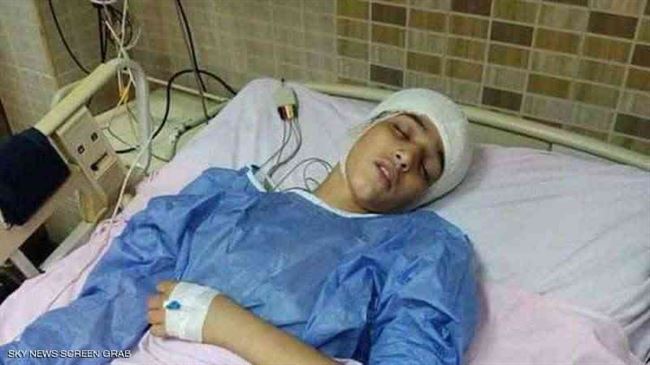 غرس مفتاح في رأس زميله.. إيداع نجم ذا فويس كيدز أسبوعا بإحدي دور الرعاية