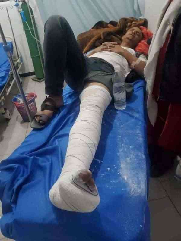 قيادي حوثي يدير قسم شرطة يدهس شاب ويرفض علاجه وأسرة الضحية تقدم شكوى ضده.. أسماء وتفاصيل