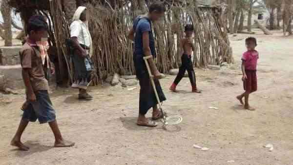 مقتل مدنيين اثنين وإصابة ثلاثة أطفال بانفجار مقذوفين من مخلفات الحرب بالحديدة