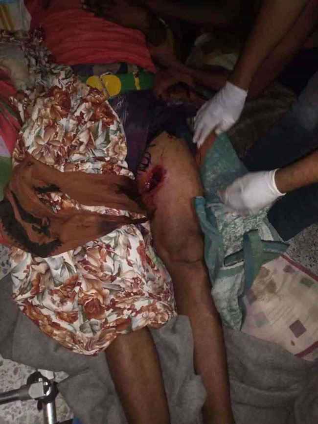 مقذوف حوثي يصيب مواطن مع طفله في تعز
