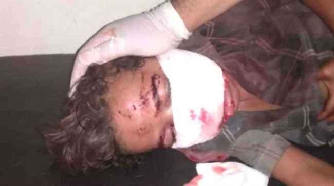 الاطفال ضحايا الذخائر والألغام في زمن الهدنة