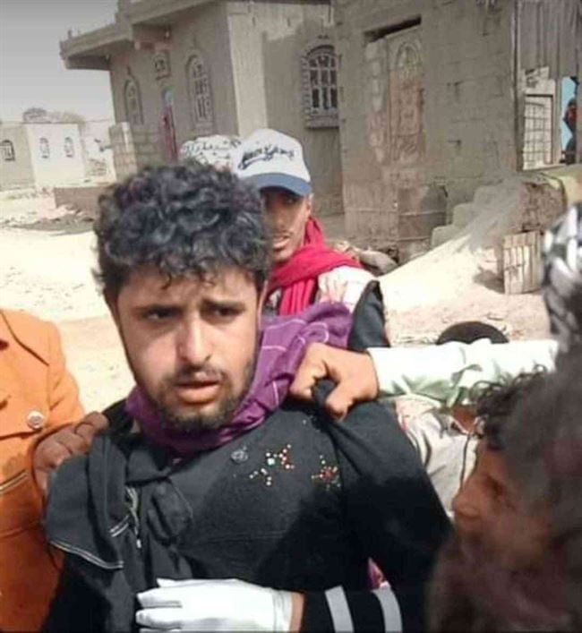 شخص يتنكر بملابس نسائية ويتسلل إلى قاعة عرس في صنعاء لتصوير الشابات (صور وتفاصيل القبض عليه)