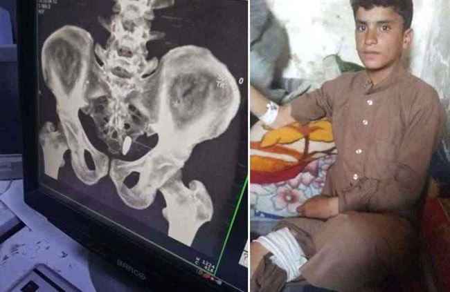 شاهد وقوع خسائر بشرية ومادية شمال صنعاء أثناء احتفال الحوثي بالولاية