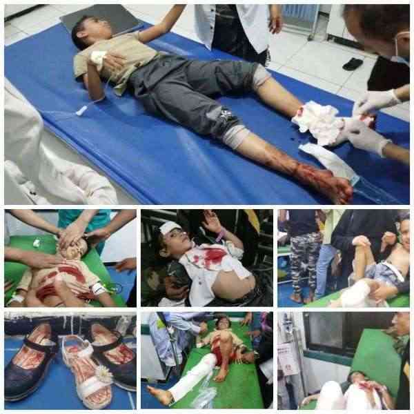 الحوثي يرتكب مجزرة مروعة سقط فيها 12 طفل بتعز.. أسماء وصور