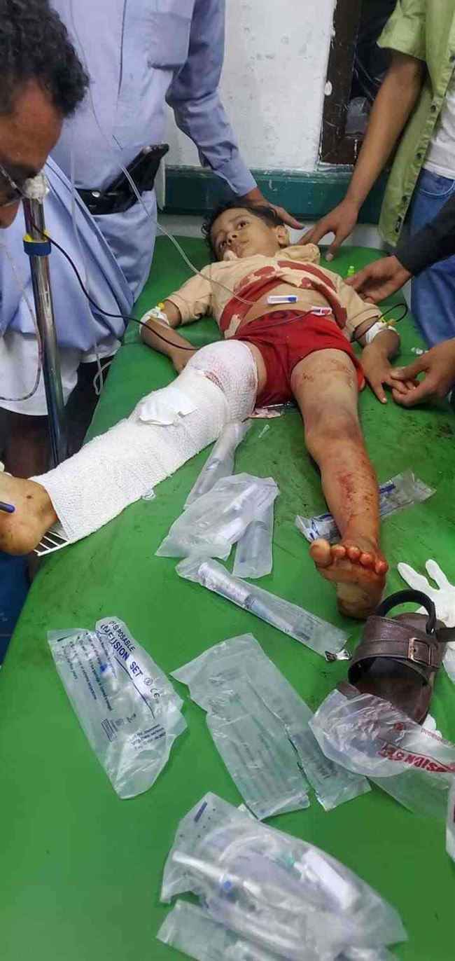 وفاة أحد الأطفال الذين اصيبوا بالمجزرة الحوثي بتعز