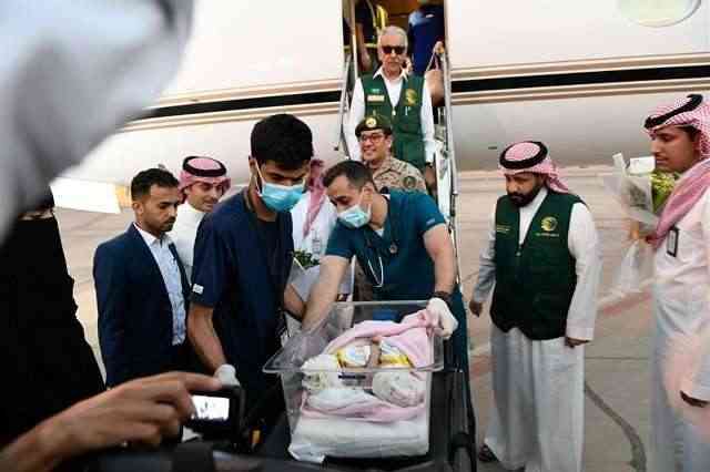 بدعم سعودي .. التوأم السيامي اليمني "مودة ورحمة" يخضع لعملية فصل