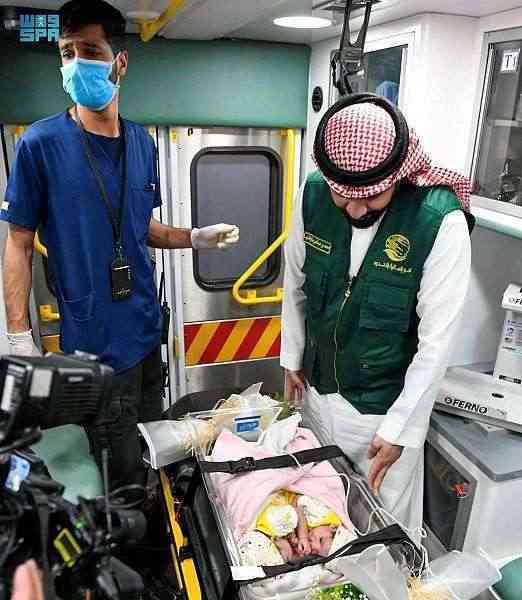 خبر يسعد اليمنيين .. نجاح عملية فصل التوأم السيامي اليمني “مودة ورحمة”