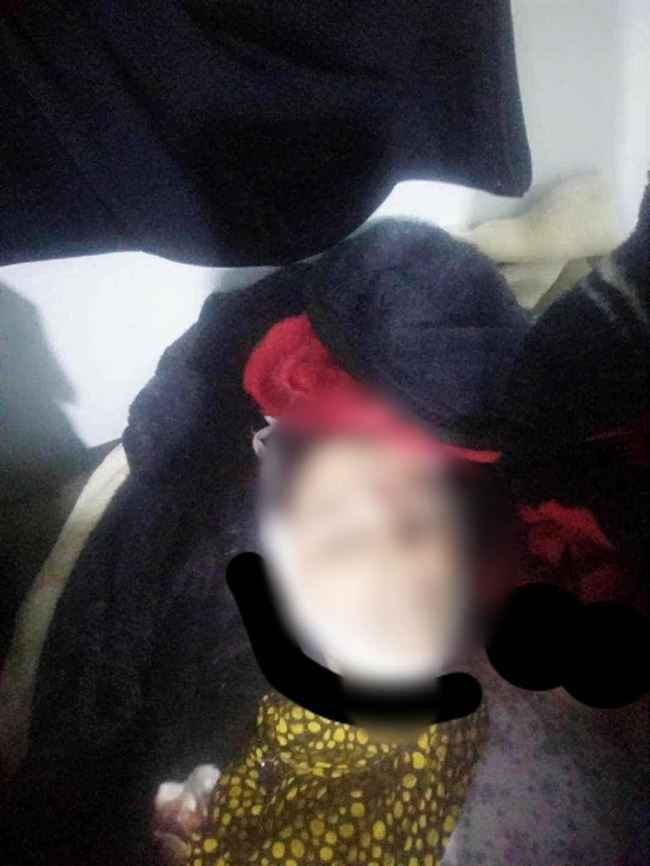 جرائم تعز تتوسع برعاية ألوية الإخوان.. ما تعرضت له "اليتيمة" مروع قبل دفنها على أيدي 3 جنود