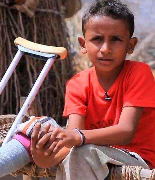 مدارس صنعاء الخاصة تغلق أبوابها في وجه الأطفال المعاقين
