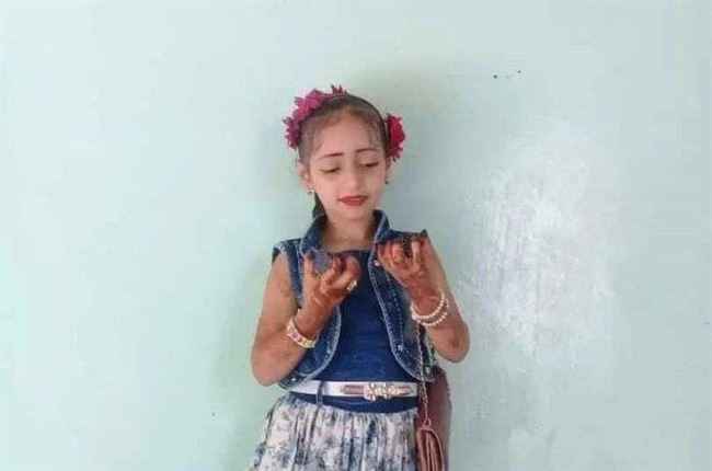تعز.. وفاة أم وطفلتها داخل حاجز مائي