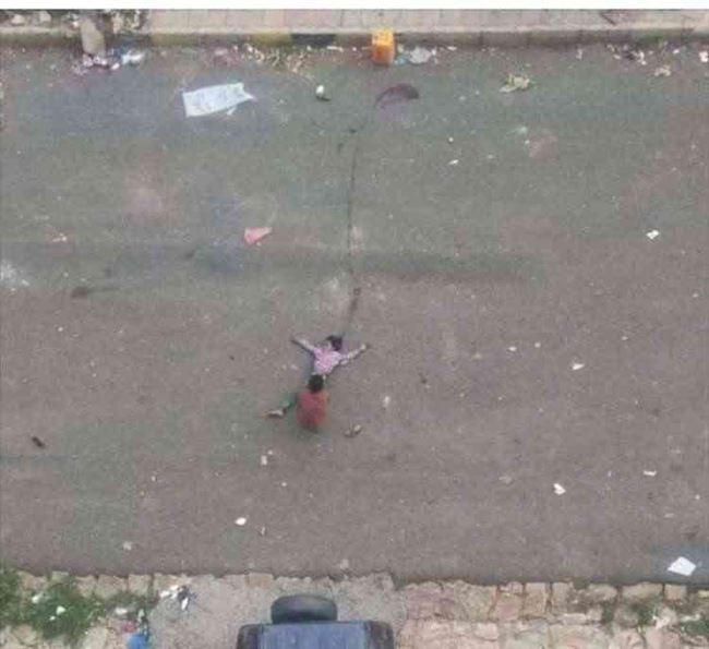 صورة.. تفاصيل مفرحة من قلب تعز بشأن #طفلة_الماء التي قنصها الحوثي