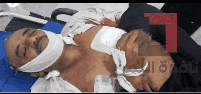 جماعة الحوثي تفتتح التمديد بنحر مواطن عائد إلى منزله شرق تعز.. شاهد