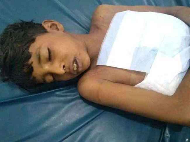 الحوثي يقتل طفل في نقطة أمنية في تعز