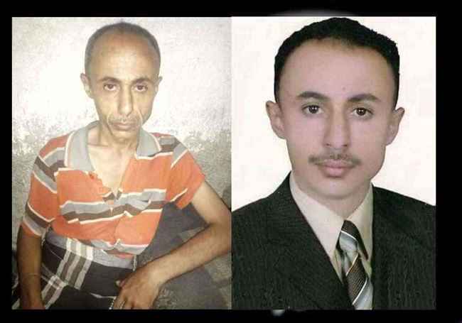 صحفي ينجح بالهرب من قبضة الحوثي إلى الضالع.. كشف تفاصيل اعتقال وتعذيبه مع صورتين مؤلمة