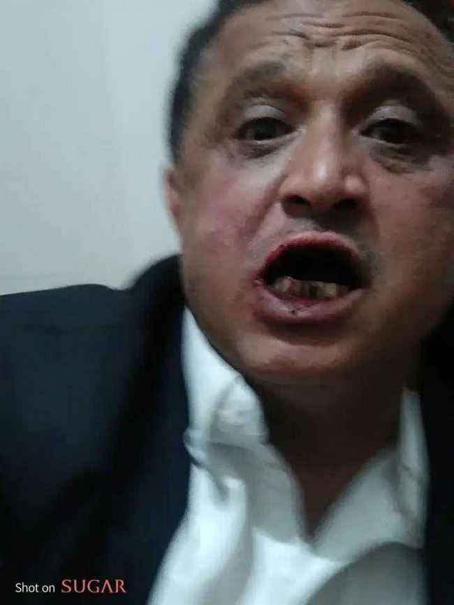 الآن في صنعاء الحوثيون يعتدون بوحشية على صحفي مشهور أمام منزله.. صور مروعة