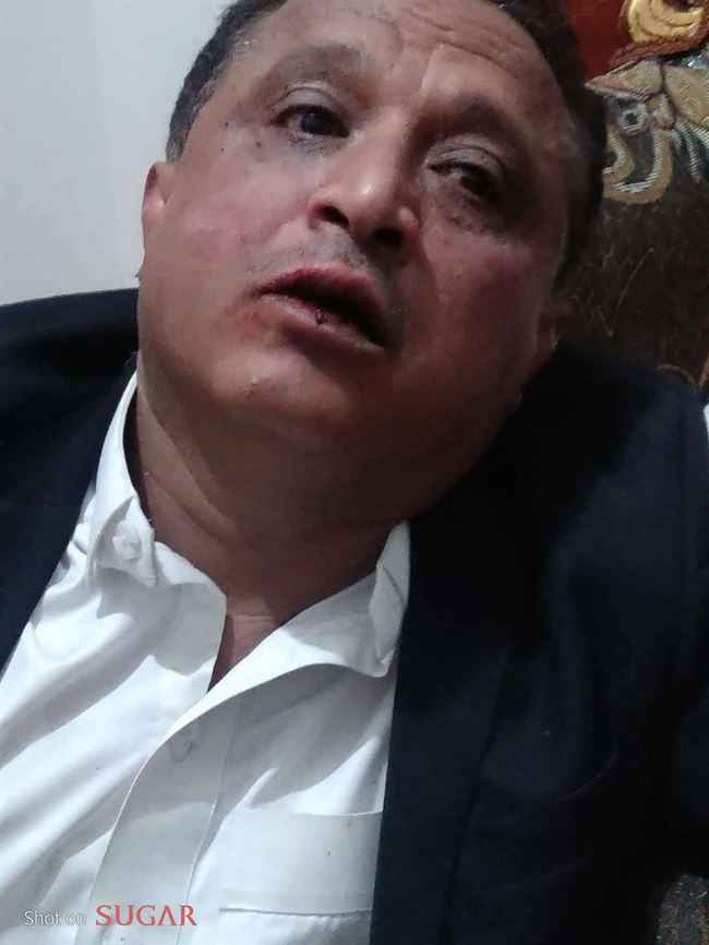 الشرعية تكشف عن الجهاز الحوثي الذي اعتدى بالضرب الوحشي على مدير إذاعة في صنعاء