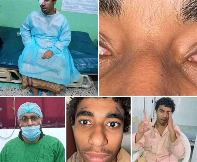ردة فعله مؤثرة.. شاب يرى النور بعد 18 عام من ولادته أعمى البصر على يد دكتور يمني