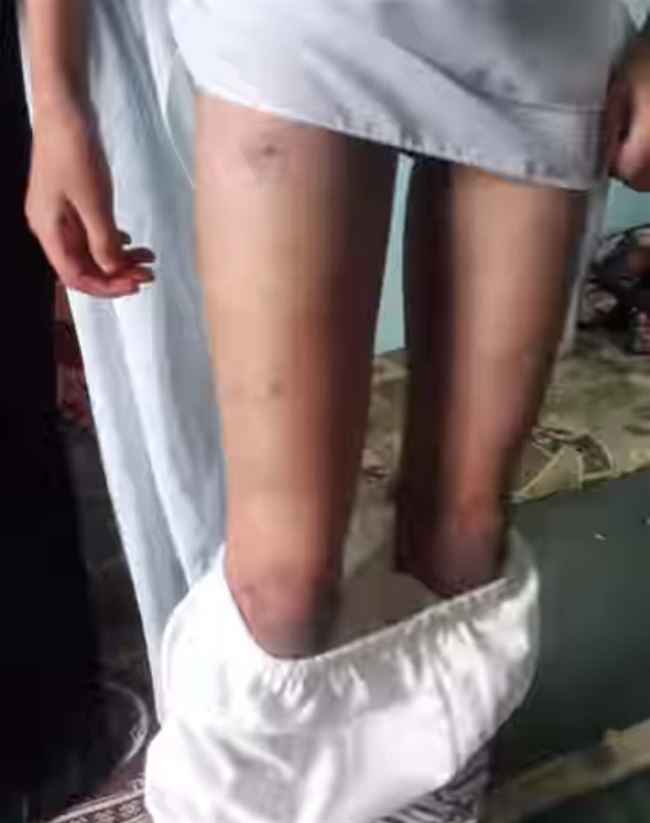 فيديو صنعاء مرعب.. اغتصاب طفلة وتعذيب أشقائها بوحشية يسرد تفاصيلها محامي كبير.. بشاعة اعمامهم