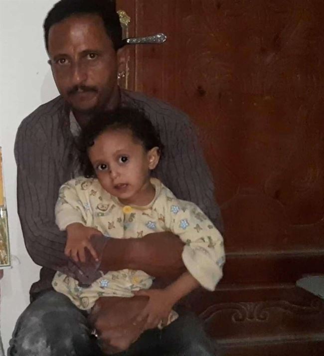 نازح في إب يشعل النار في جسده بعد أخذ حصته من الغاز المنزلي.. صورة مؤلمة
