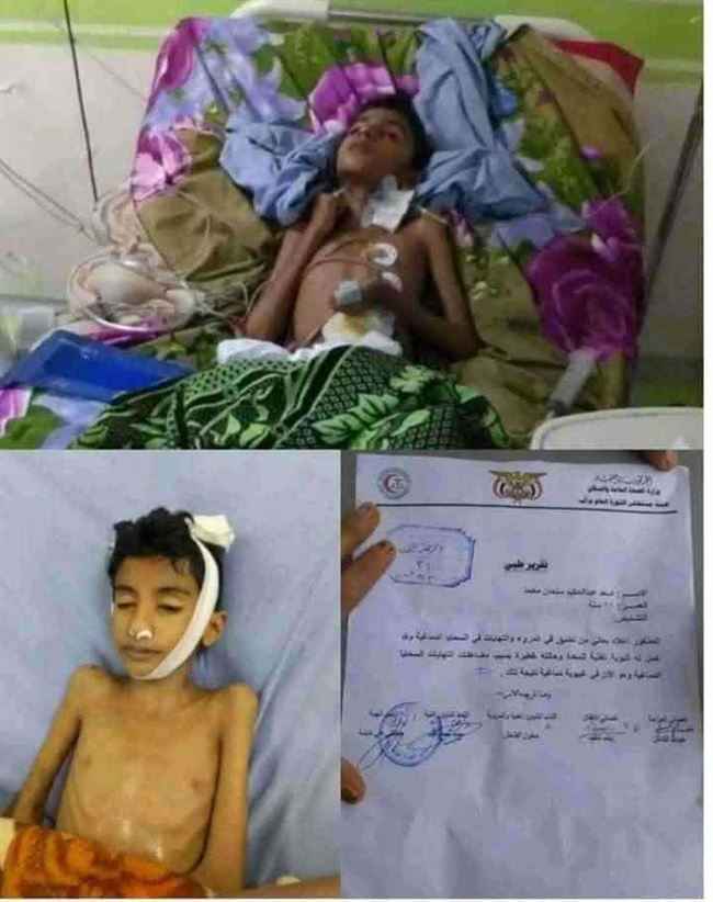 حجز جثة طفل في مستشفى حكومي بـ257 ألف.. يعالج الحوثيين مجانا منذ 8 سنوات