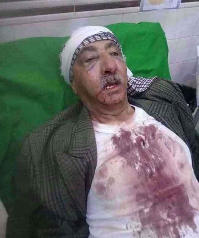 اعتداء وحشي بالبنادق يطال شيخ قبلي داخل منزله وأمام أسرته شمال صنعاء.. شاهد كيف تغيرت ملامح الوجه