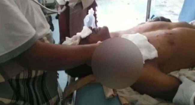 انفجار حوثي يستهدف مزارع.. اعطب حراثته وإصابته بالغة