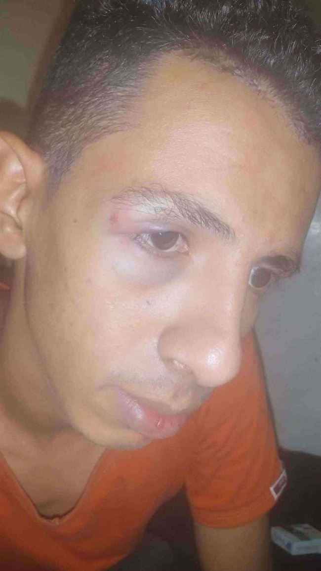 انتقد قائد محور تعز.. اختطفه مسلحون وعذبوه بوحشية داخل مدرسة (صور هزت اليمنيين)