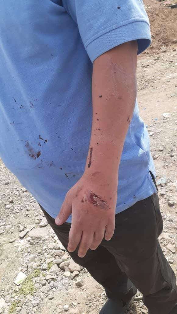 تجهيز طائرات حربية في صنعاء بمشاركة خبراء إيرانيين.. صور اعتداء وحشي يطال الكبسي